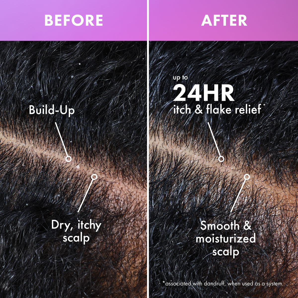 Lavender & Lychee Scalp Soothing Daily Refresher